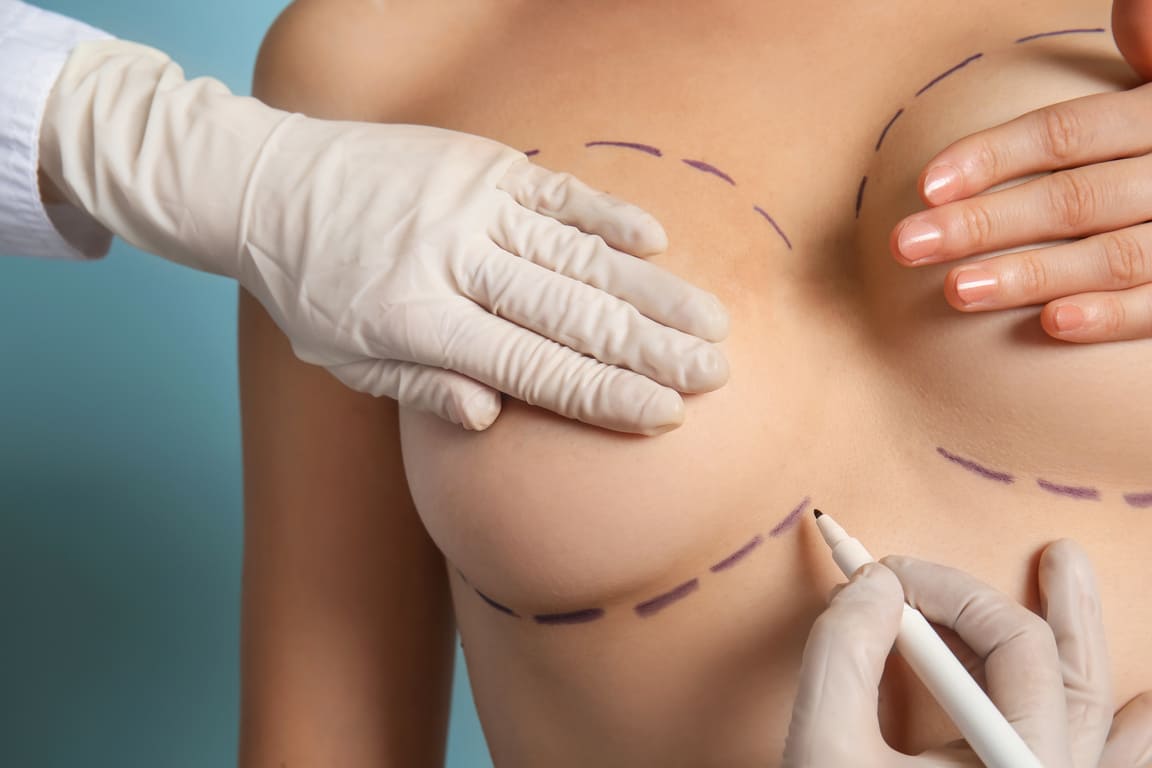 Doctor Drawing Marks on Female Breast before Cosmetic Surgery Operation against Color Background